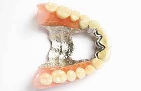 Unlocking Value: How Dental Scrap Recycling Works post thumbnail image